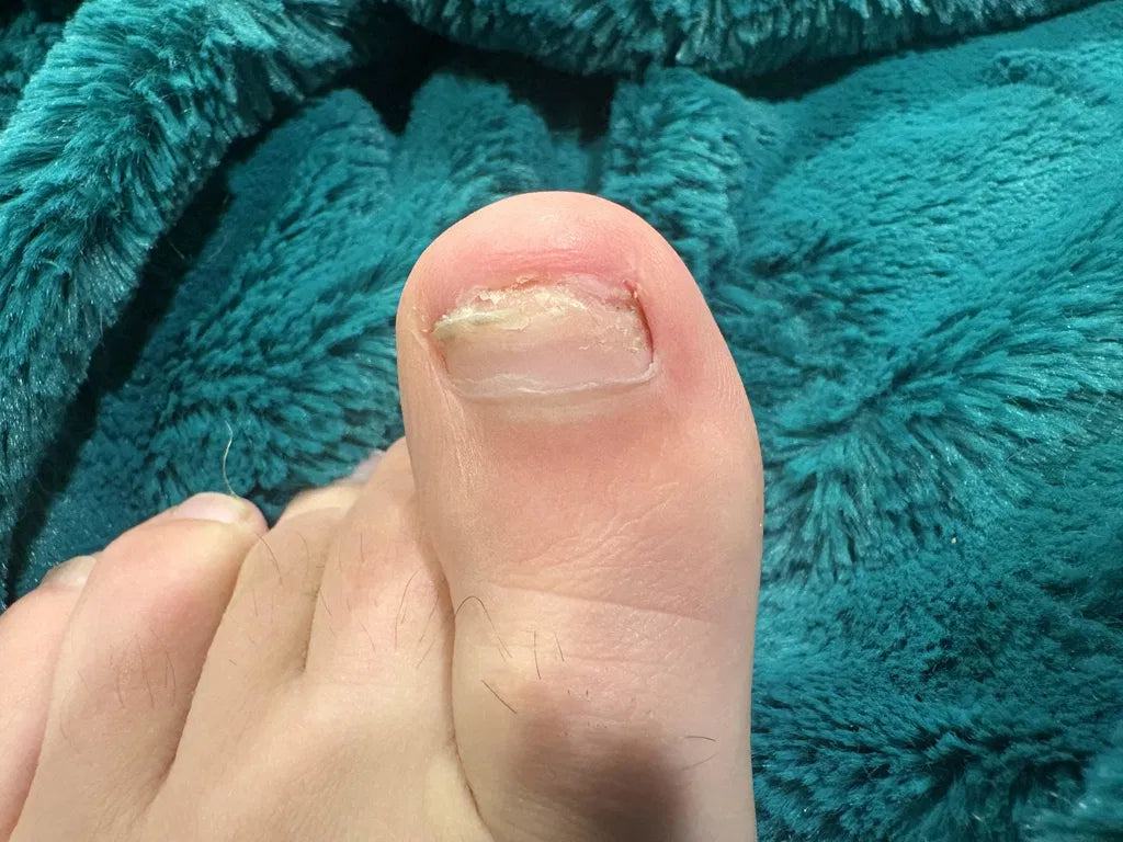 After NOHAJI Treatment