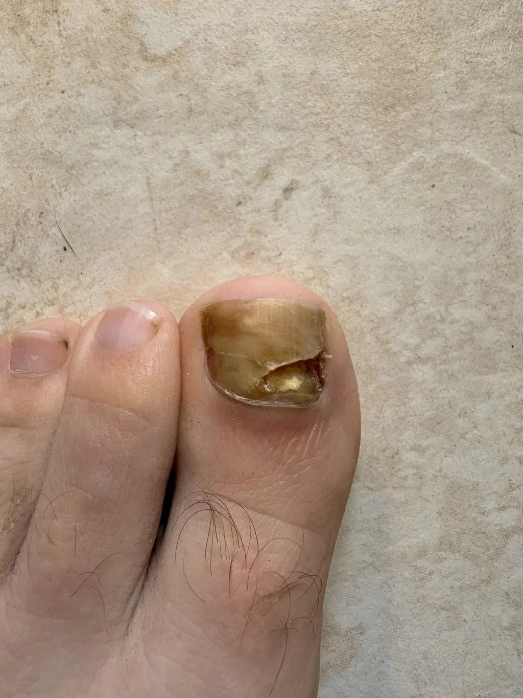 Before NOHAJI Treatment